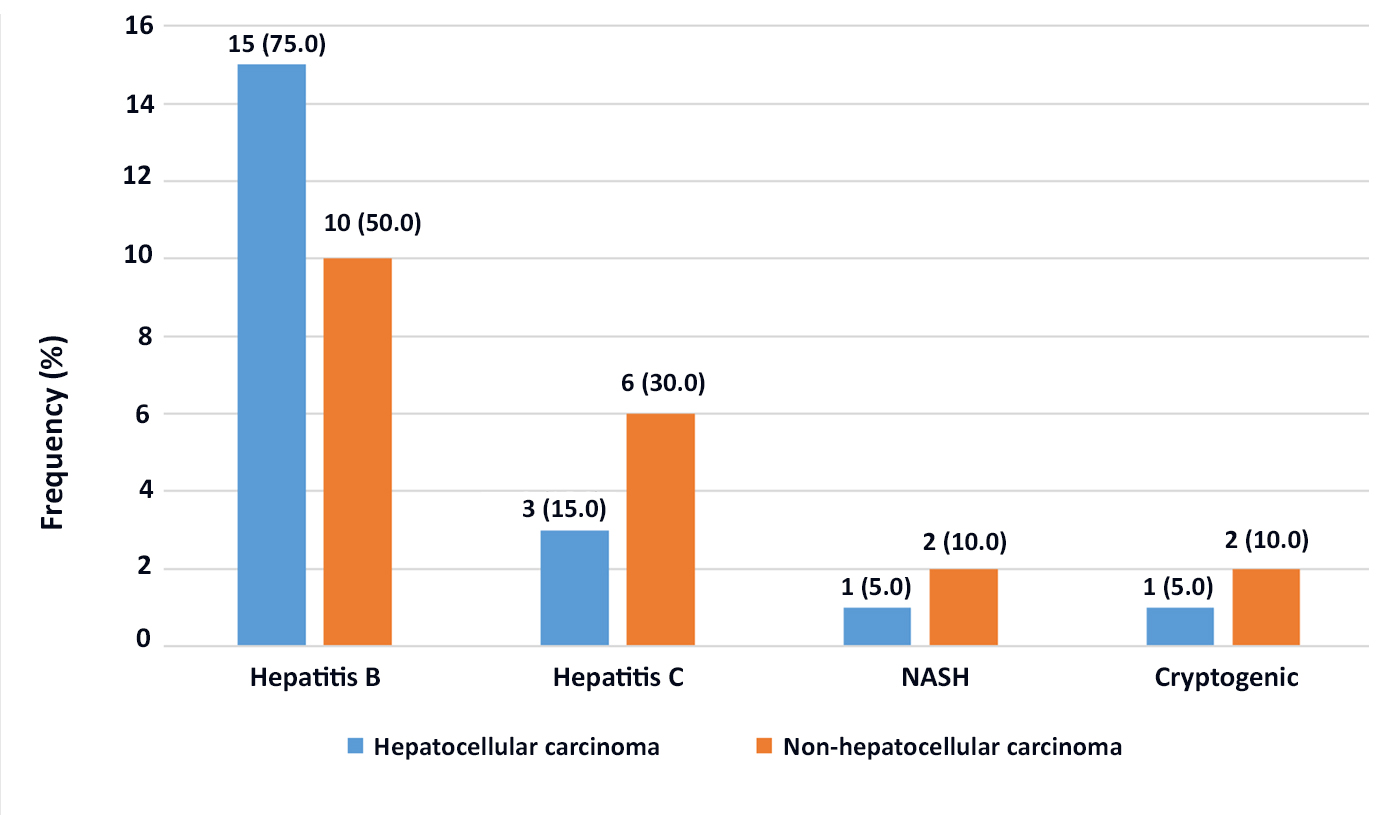 Figure 1 - Etiology of Liver cirrhosis of the participants with or without hepatocellular carcinoma (n=40)