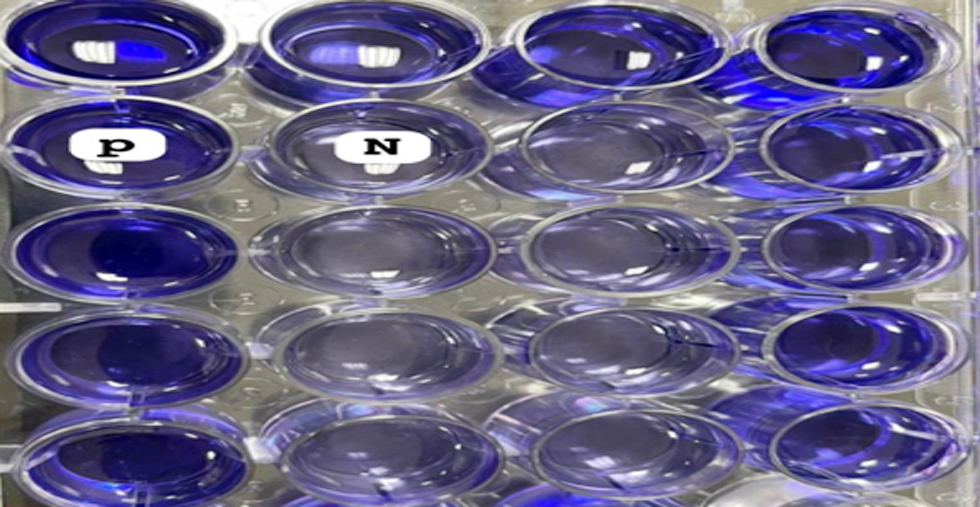 Figure 1 - Screening of biofilm producers by TCP method: high and non-slime producers differentiated with crystal violet staining in 96 well tissue culture plate.