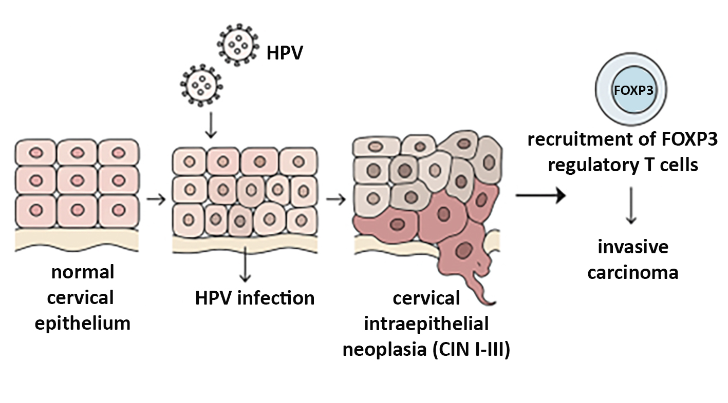 <strong>Figure 1 - Overview of HPV-induced cervical carcinogenesis and FOXP3 involvement</strong>