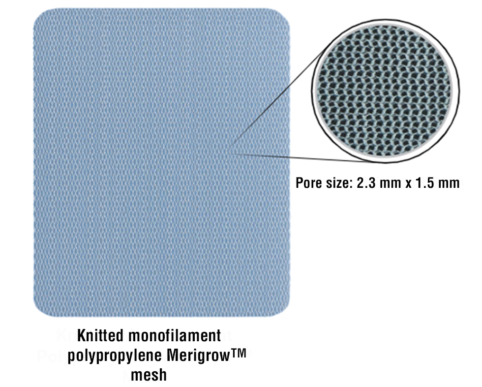 Figure 2 - A representative image of the Knitted Monofilament Polypropylene Merigrow™ Mesh depicting its structural architecture. The magnified inset highlights the uniform pore size (2.3 mm × 1.5 mm), which facilitates optimal tissue integration and host response.