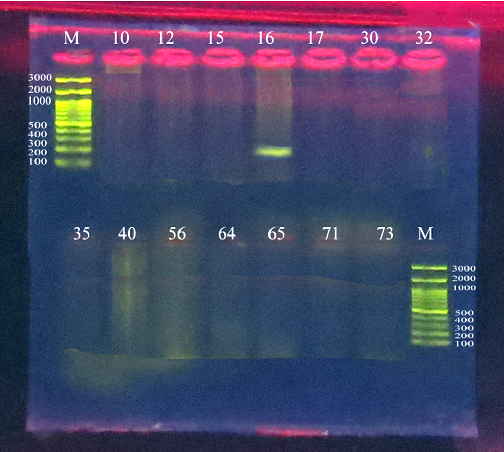 Figure 1 - Electrophoresis of a PCR product of Entamoeba gingivalis with a size of 204 bp, using agarose gel at a concentration of 1.5%, at a voltage of 70 V and 85 mA, for 45 minutes. For positive microscopy.