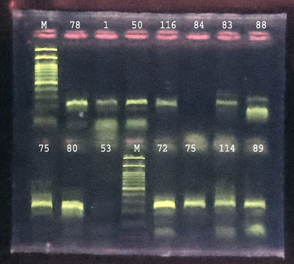 Figure 2 - Electrophoresis of a PCR product of Entamoeba gingivalis with a size of 204 bp, using agarose gel at a concentration of 1.5%, at a voltage of 70 V and 85 mA, for 45 minutes. For negative microscopy.