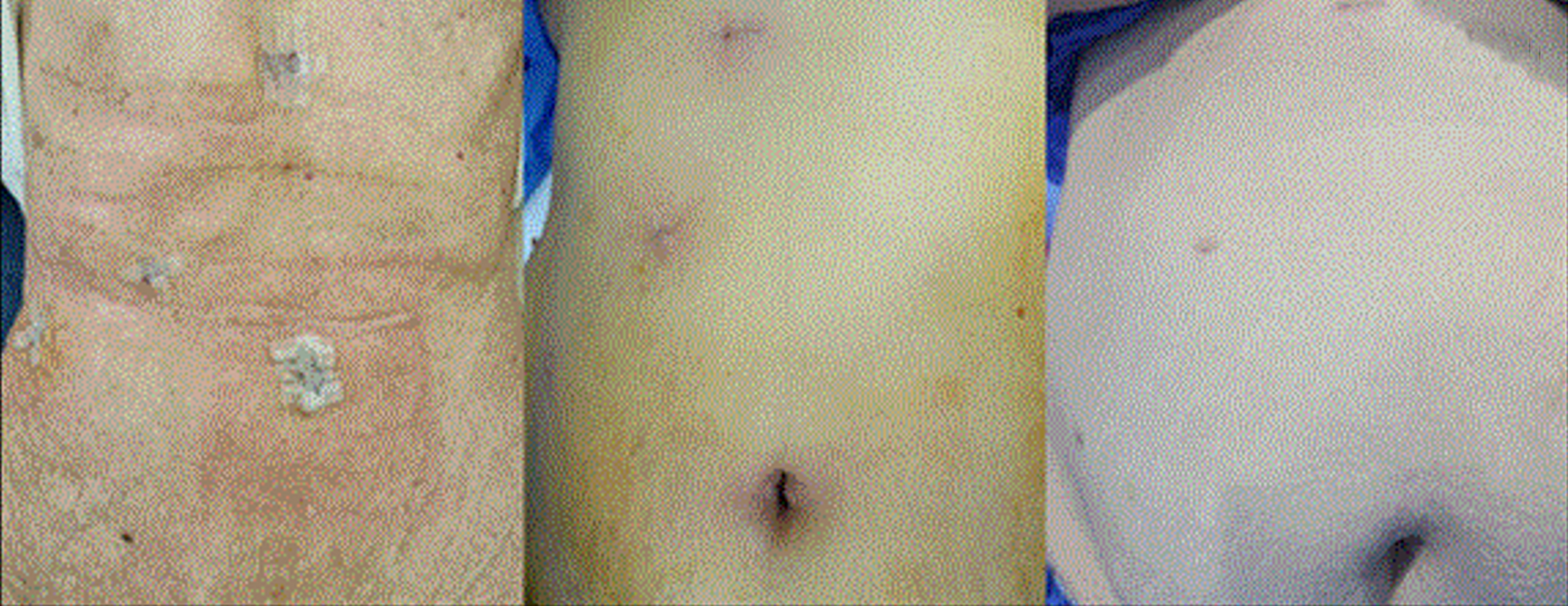 fig 4