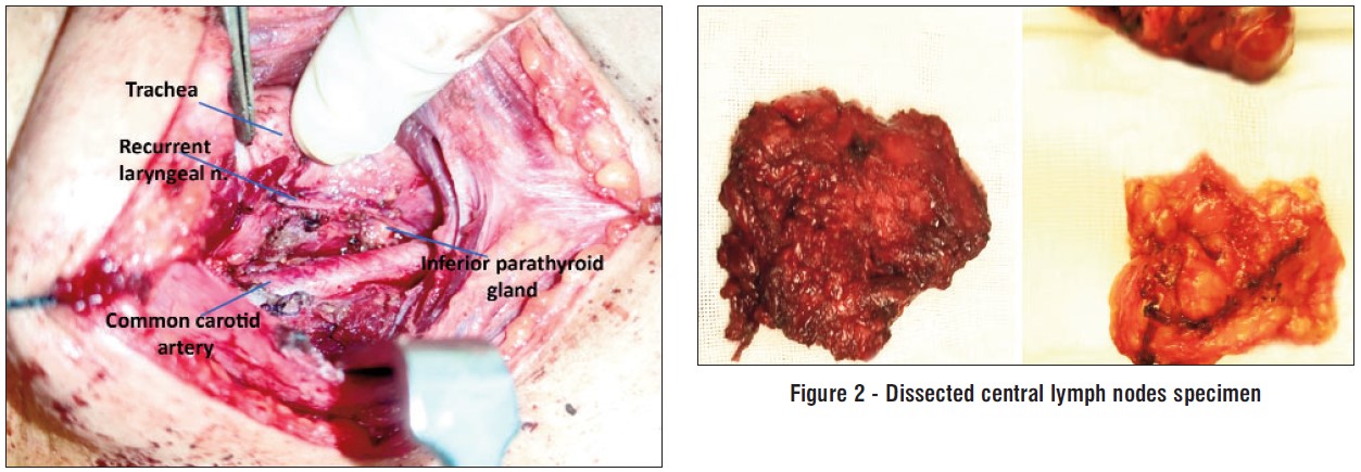 fig 1, 2